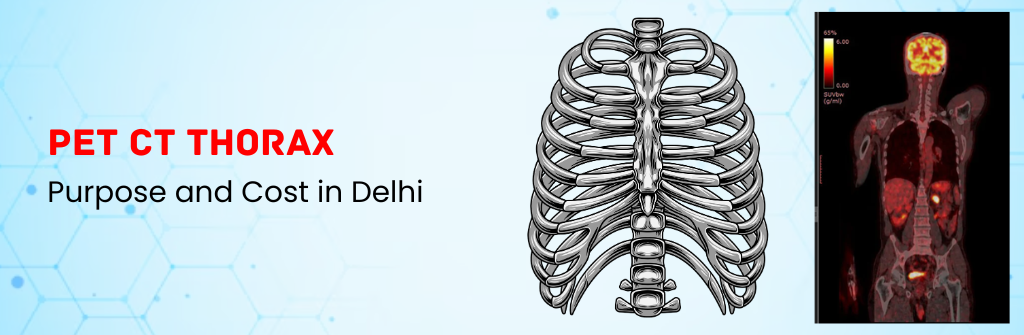 PET CT Thorax: Purpose and Cost in Delhi